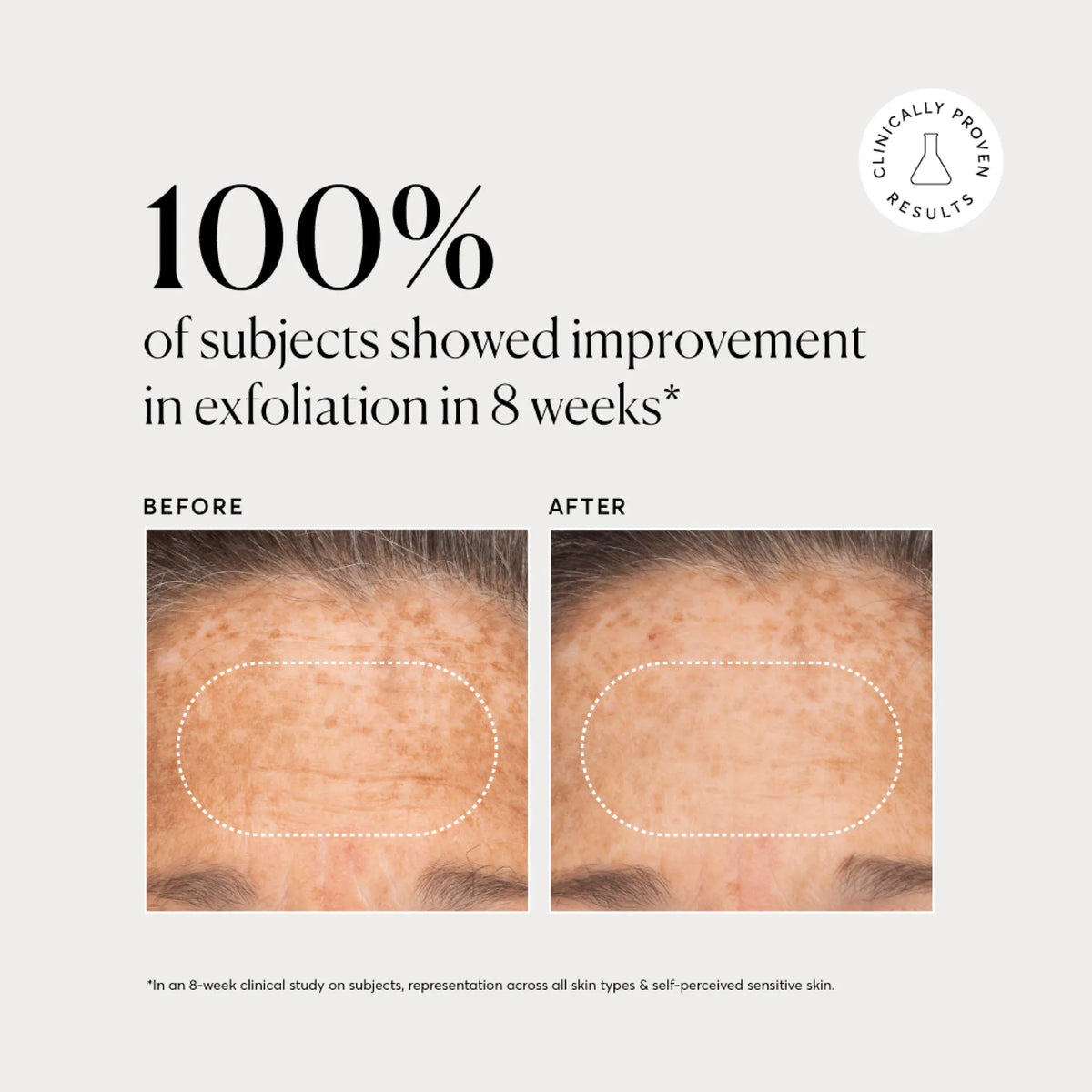bha-liquid-exfoliant-2-f1 NATR-10027-Alt-Images-BHA-Liquid-Exfoliant-2_-03.webp